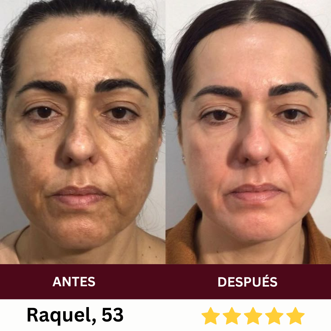 Máscara de Colágeno + Varita Facial LED — Rejuvenece tu piel desde la primera semana