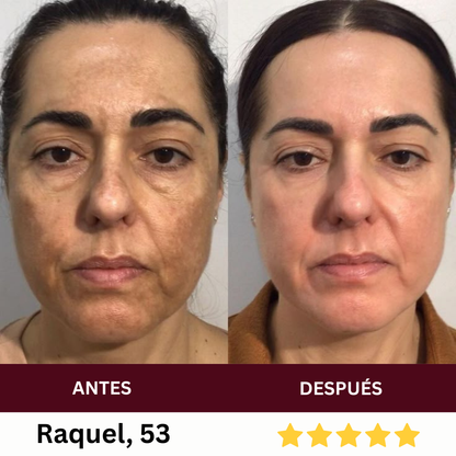 Máscara de Colágeno + Varita Facial LED — Rejuvenece tu piel desde la primera semana