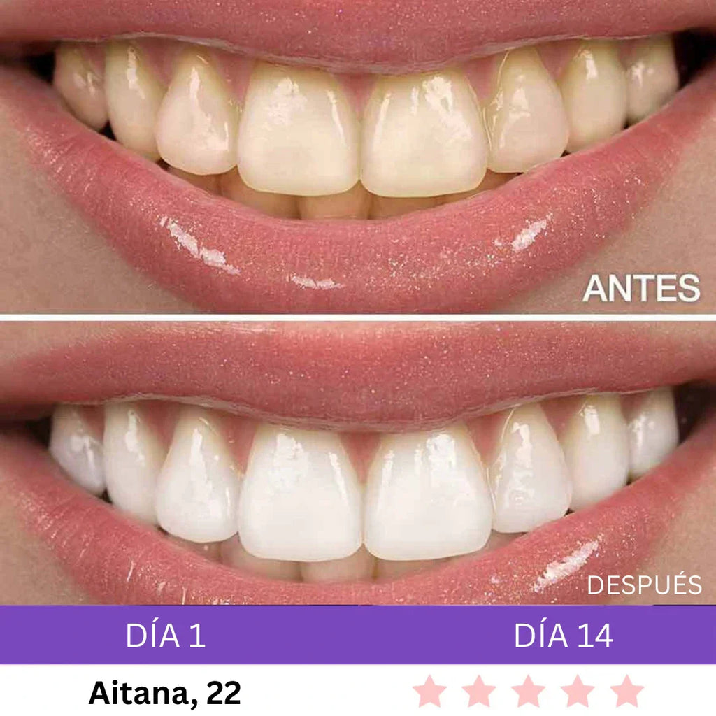 Combo Blanqueador LED + Gel V34® - Blanqueamiento Rápido en Casa