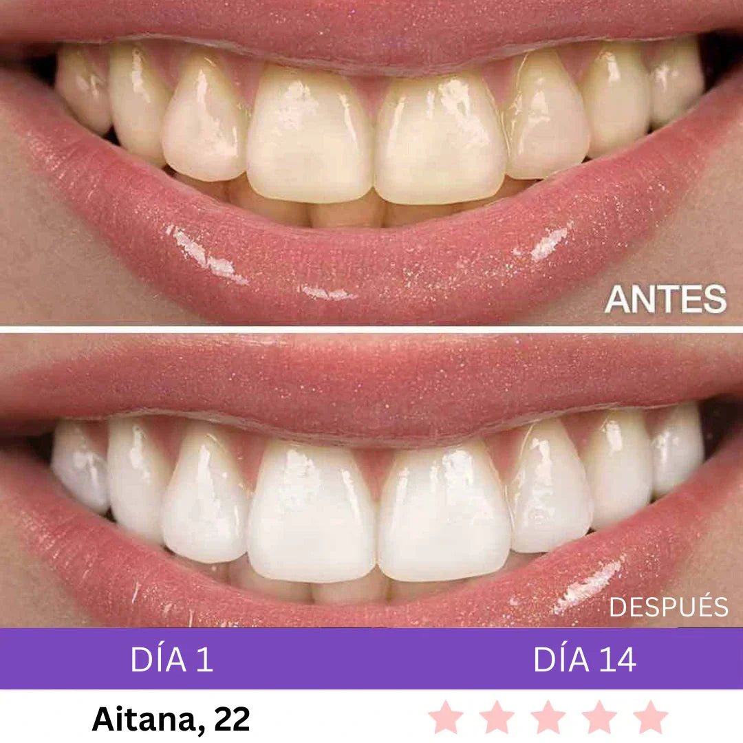 Combo Blanqueador LED + Gel V34® - Blanqueamiento Rápido en Casa