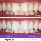Combo Blanqueador LED + Gel V34® - Blanqueamiento Rápido en Casa