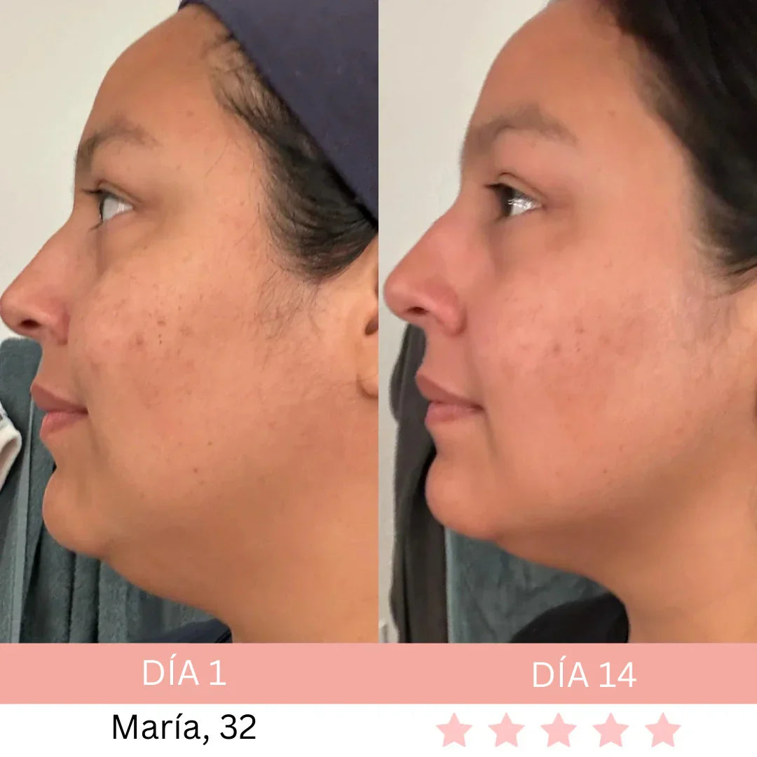 Masajeador Facial® + E-book GRATIS - Activa Tu Brillo Natural