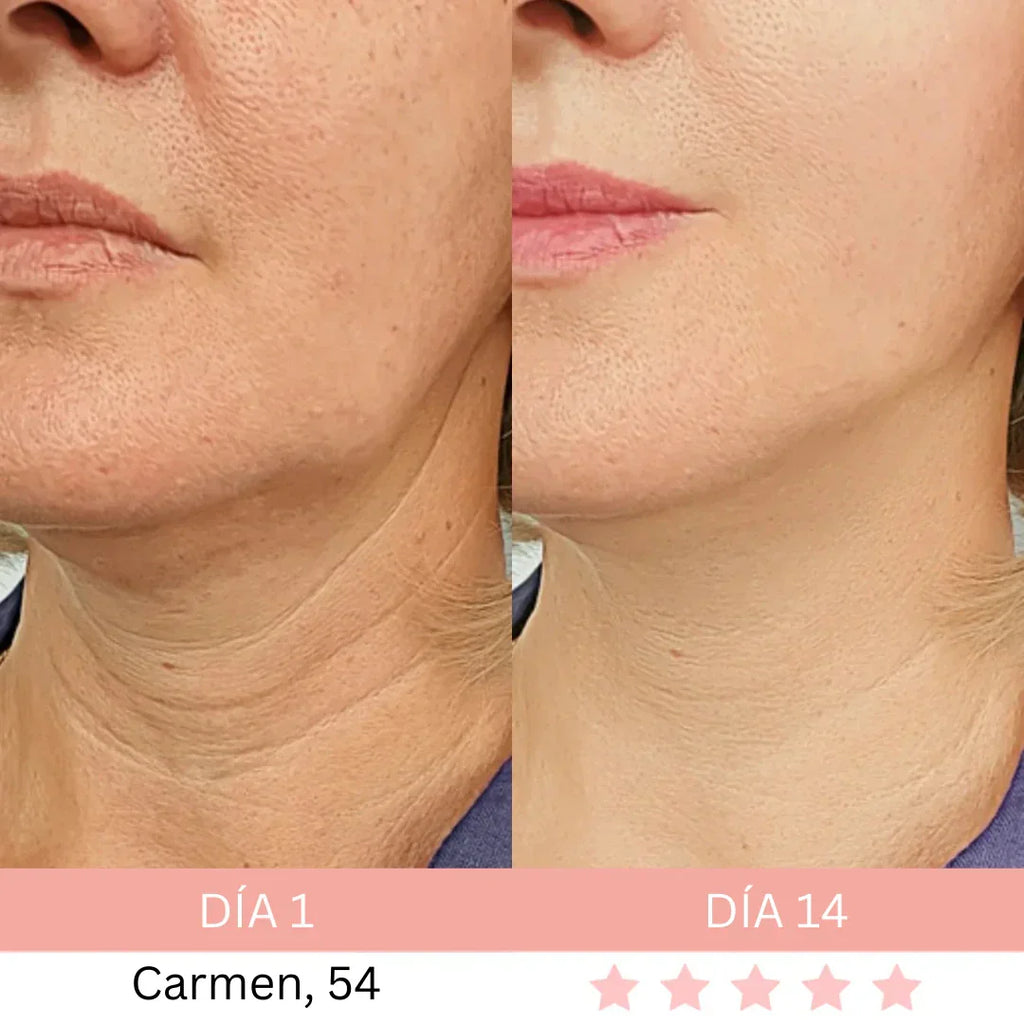 Masajeador Facial® + E-book GRATIS - Activa Tu Brillo Natural