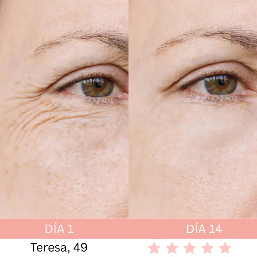 Masajeador Facial® + E-book GRATIS - Activa Tu Brillo Natural