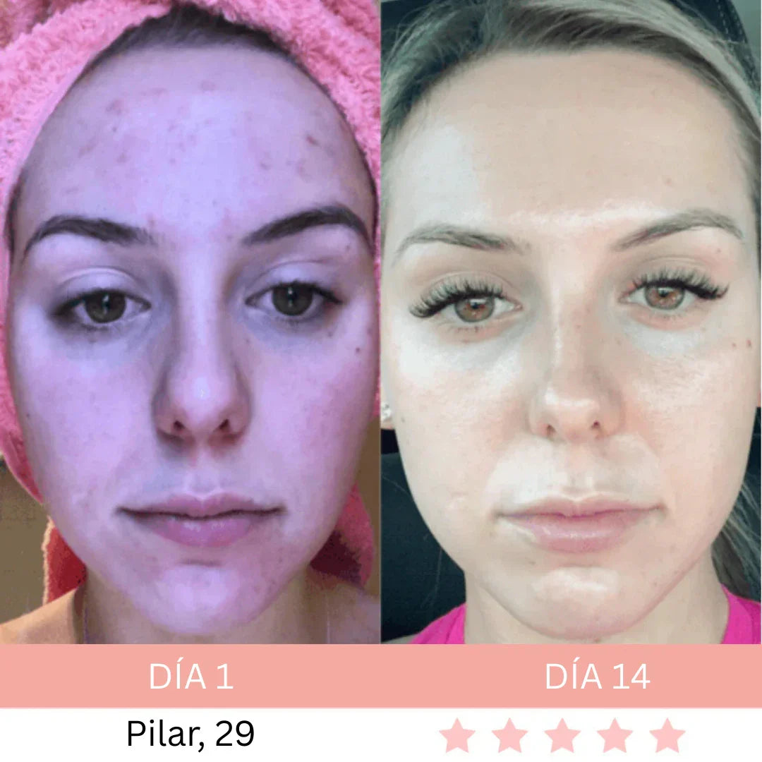 Masajeador Facial® + E-book GRATIS - Activa Tu Brillo Natural