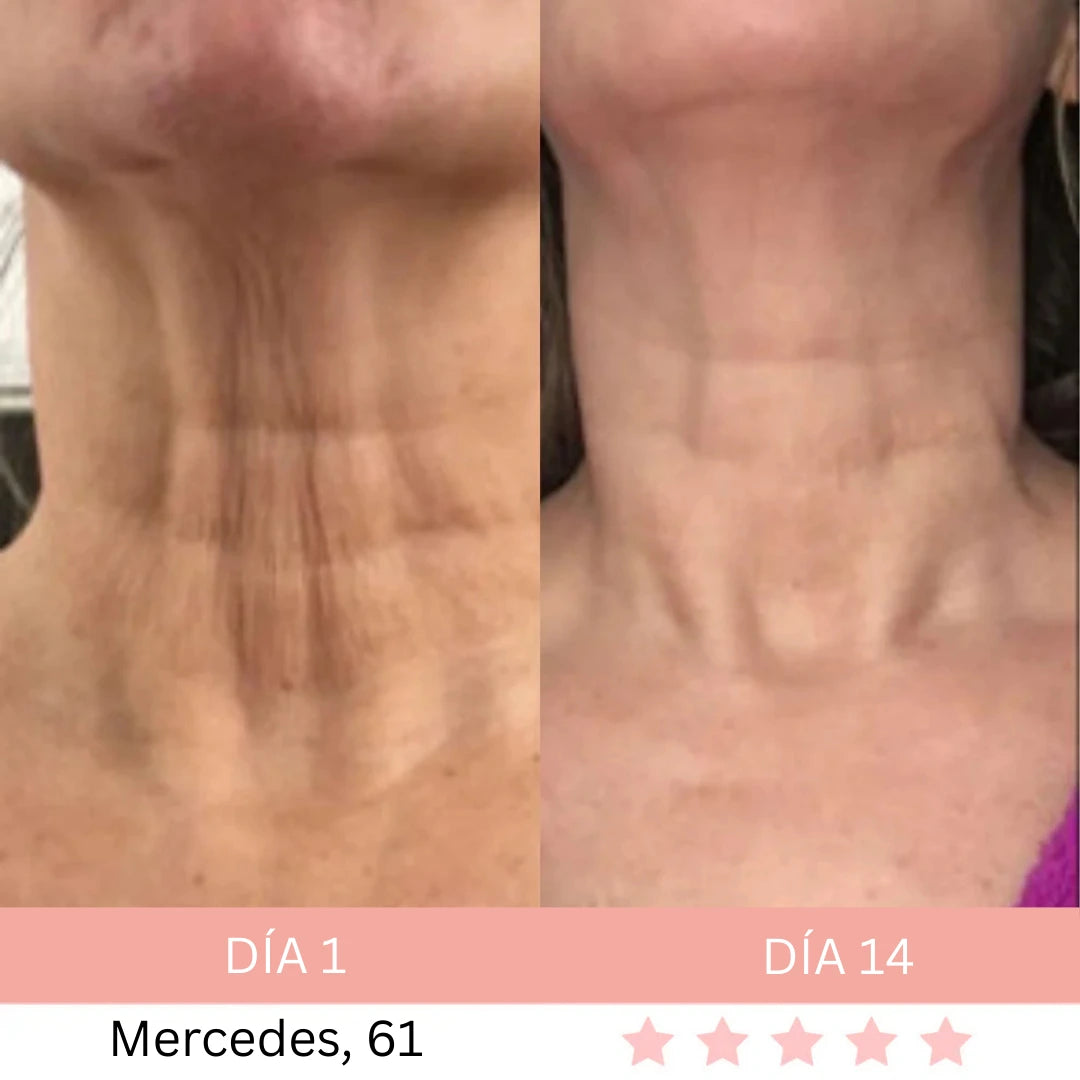 Masajeador Facial® + E-book GRATIS - Activa Tu Brillo Natural