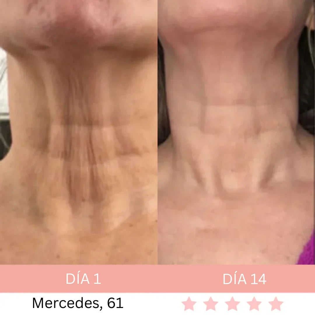 Masajeador Facial® + E-book GRATIS - Activa Tu Brillo Natural