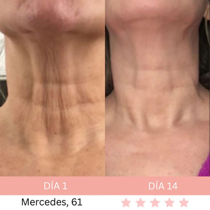 Masajeador Facial® + E-book GRATIS - Activa Tu Brillo Natural
