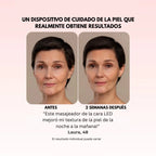 Masajeador Facial® + E-book GRATIS - Activa Tu Brillo Natural