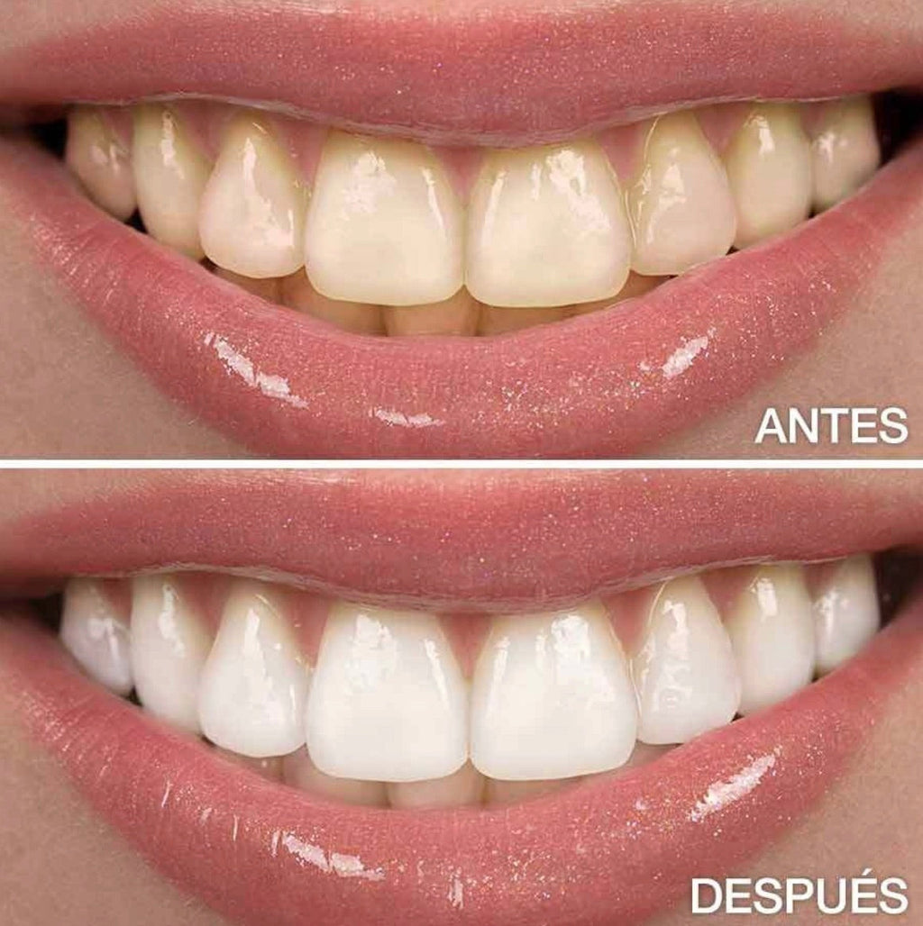 Dientes hasta 7 tonos más blancos en 2 minutos — sin sensibilidad