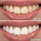 Dientes hasta 7 tonos más blancos en 2 minutos — sin sensibilidad