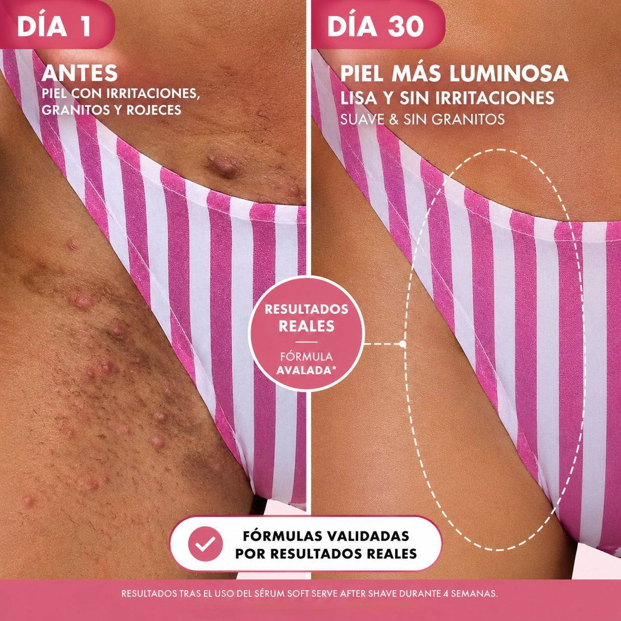 Aceite Aromático After Shave - Piel Suave y Sin Granitos Después del Afeitado