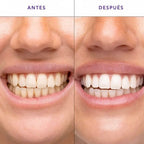 Tiras Blanqueadoras para Dientes – Sonrisa Más Blanca al Instante